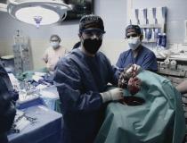 Cirurgia com coração de porco, nova era dos transplantes | Portal Obidense